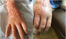 你的美灼伤了我的眼_800字