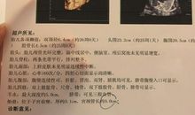 重活一次之星星的话_250字