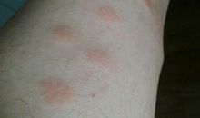 蚊子为什么咬我_250字