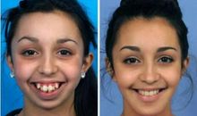 奇妙的“脸”_450字