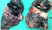 请记住，生命在倒计时_1200字