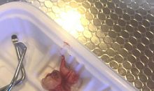 第一次拔牙_700字