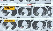 关于新型冠状病毒肺炎作文：抗击新型肺炎疫情作文篇四_600字