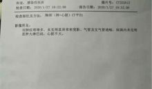 关于新型冠状病毒肺炎作文：新型冠状病毒肺炎作文篇一_450字