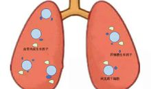 关于新型冠状病毒肺炎作文：新型冠状病毒肺炎4_600字