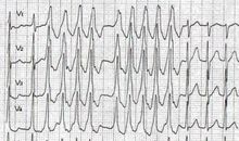 第1章遇见幻心_700字