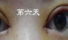 那双宿命的眼 第一卷_650字