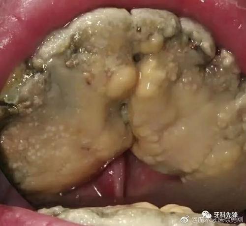 第三章“快速邪恶......”母亲用他的最后一件事来撤退，“不！”如果你不能相信他面前的一切，他呼出了他的力量。外出，那个男人不是什么，只要它杀死这个女人，我就知道，但我知道我是否要离开他，当我在他面前暴露的银色时，他说：“追逐“