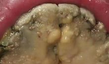 银发九尾狐_750字